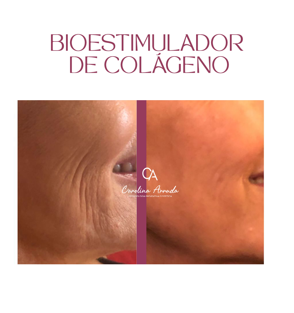 COLÁGENO